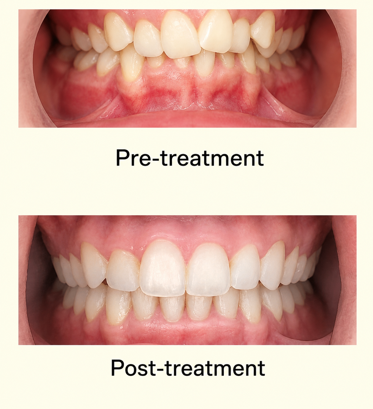 Before Smile Makeover